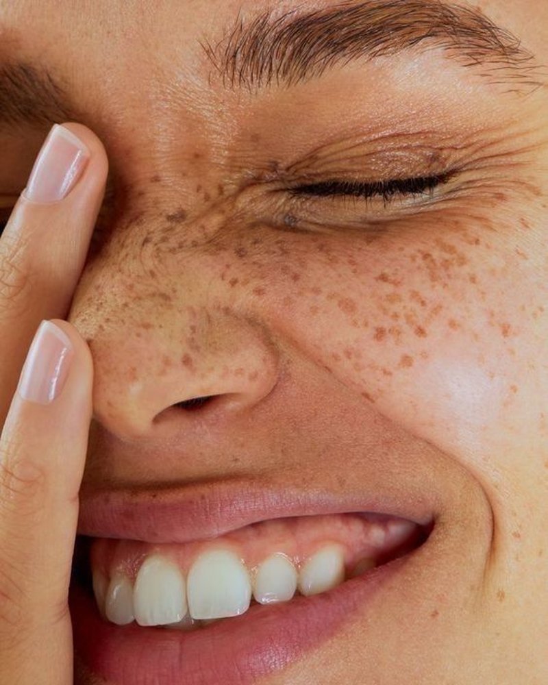 Una sonrisa real de Smile On, en primer plano